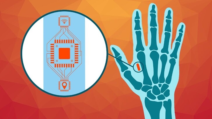 MICROCHIP_manodestra