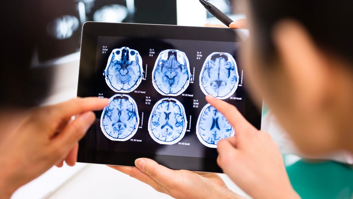 immagini dal cervello