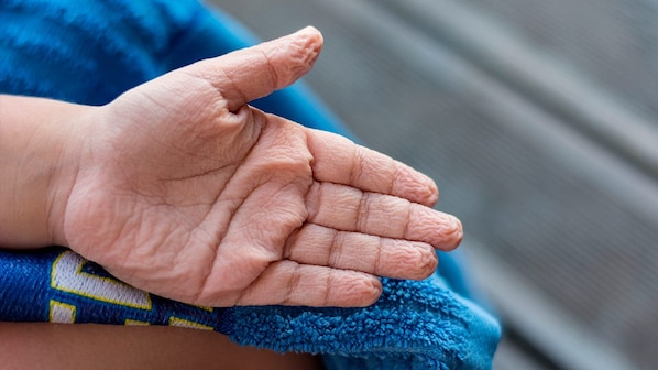 dita raggrinzite acqua perche.jpg