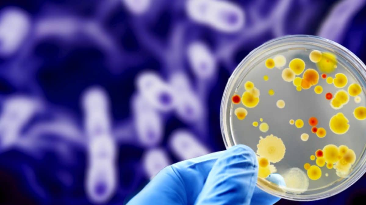 Antibiotico-resistenza cos'è