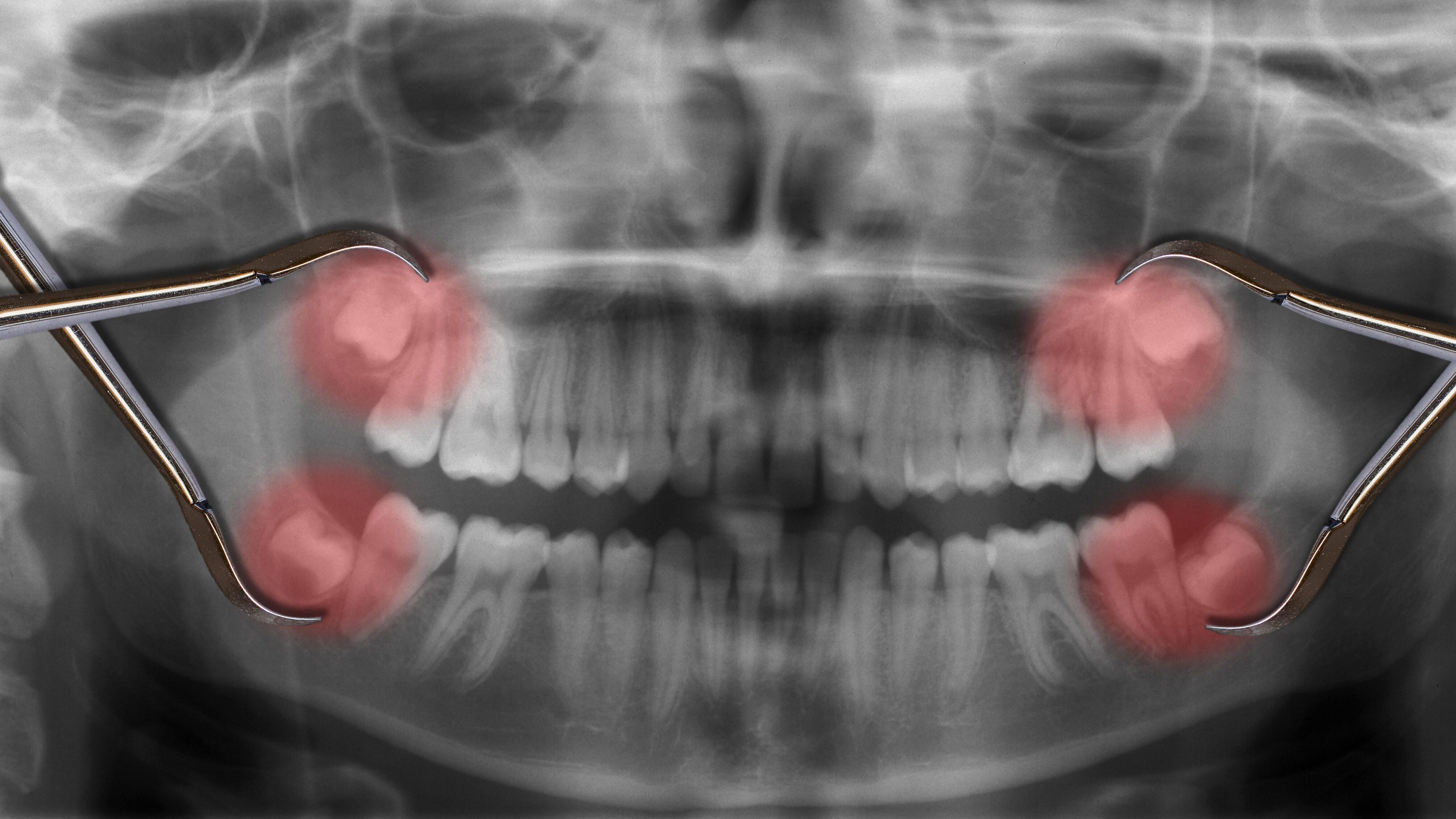 denti del giudizio