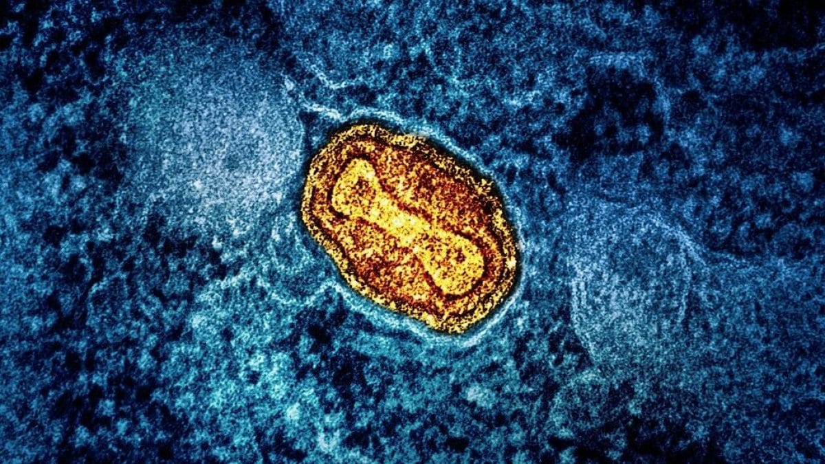 vaiolo delle scimmie virus