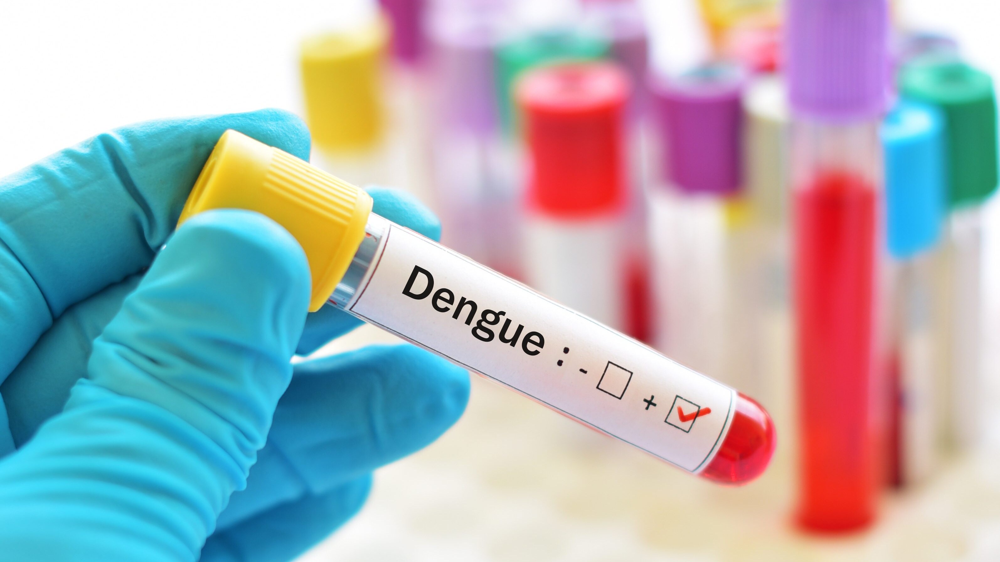 dengue cos'è sintomi come si trasmette