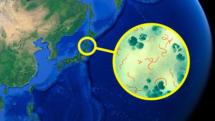 Malattia carnivora in giappone