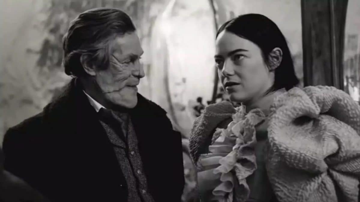 povere creature trapianto testa cervello