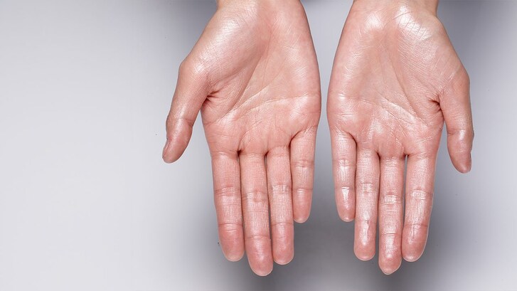 Perché ci sudano le mani