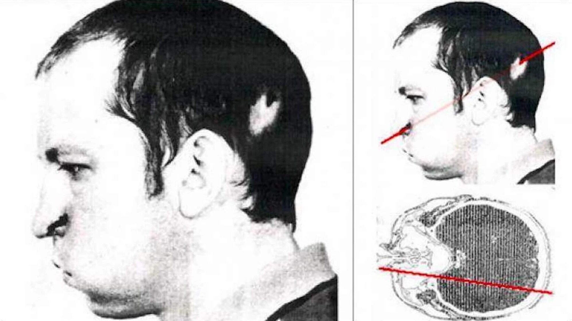 Il fascio di protoni che colpì Bugorski