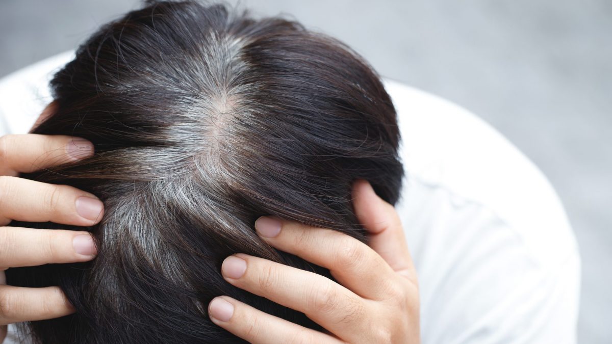 stress capelli bianchi