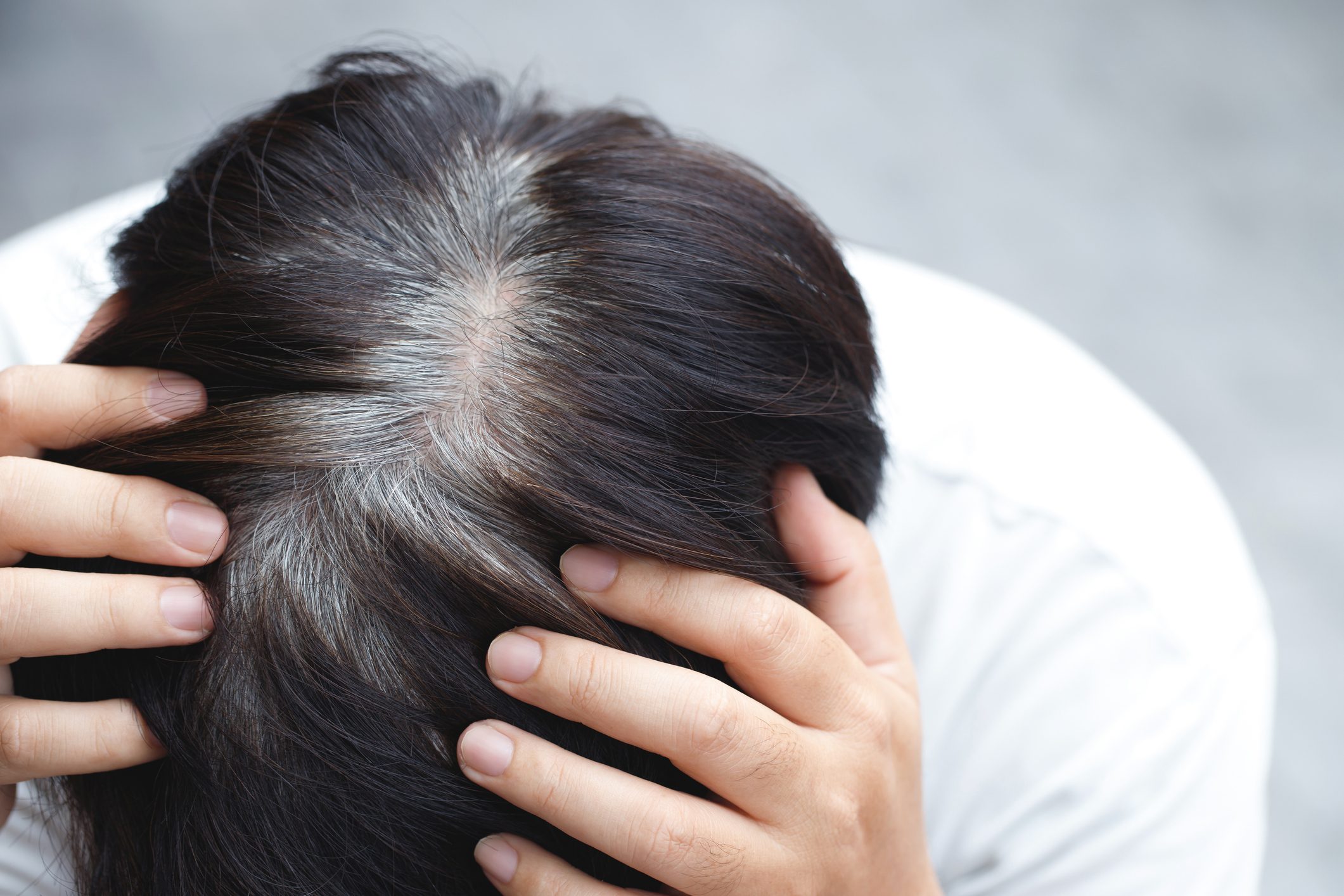stress capelli bianchi