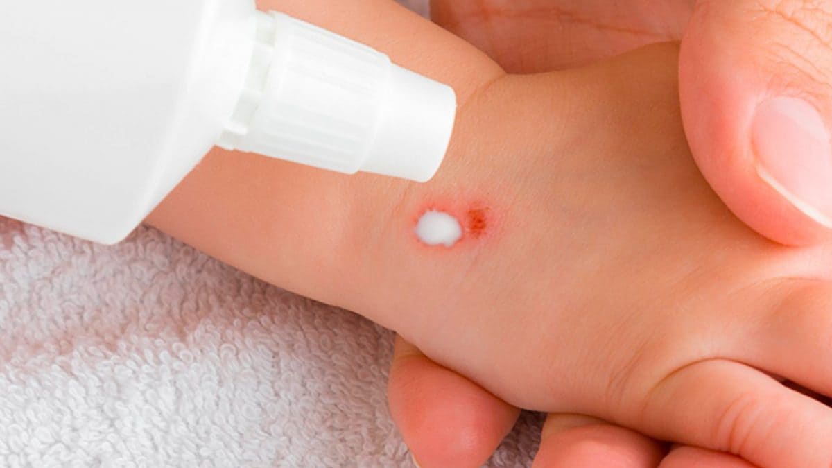 Perche acqua ossigenata schiumetta