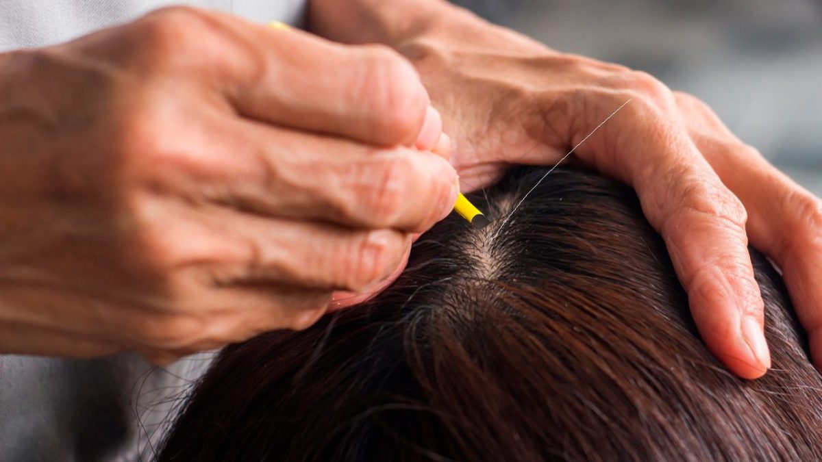 strappare capello bianco con una pinzetta