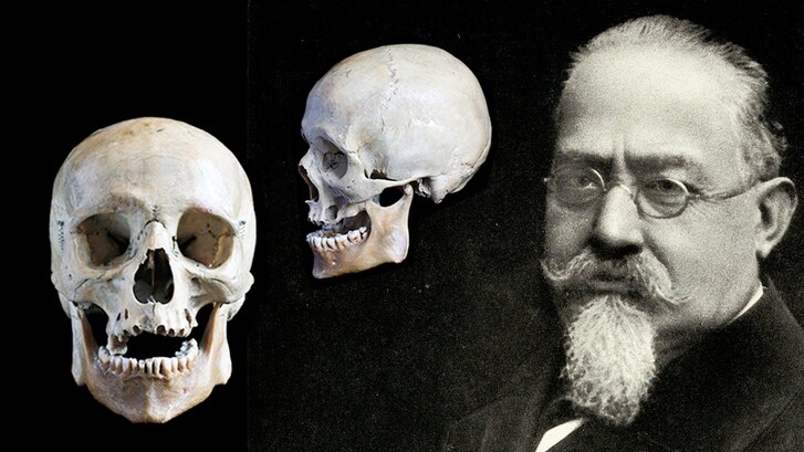 cesare lombroso teoria delinquente nato gene criminale