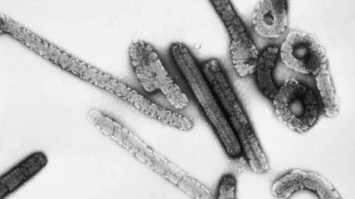 Marburg_virus