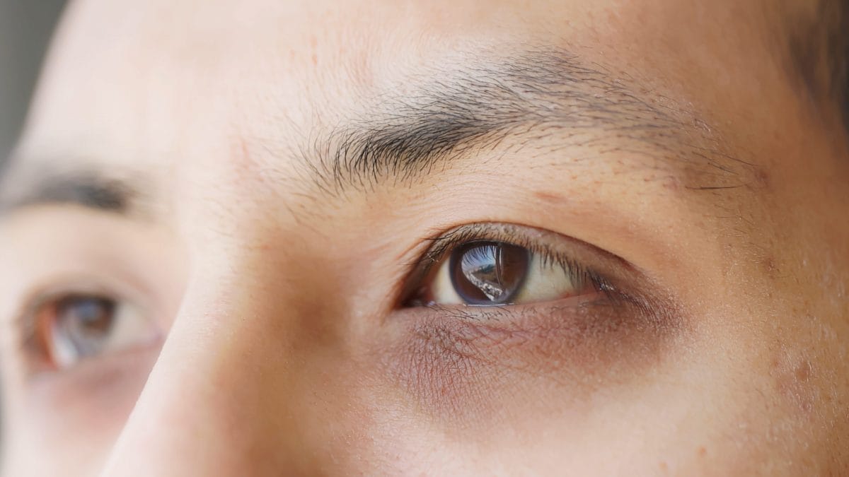 Occhiaie dormire blu