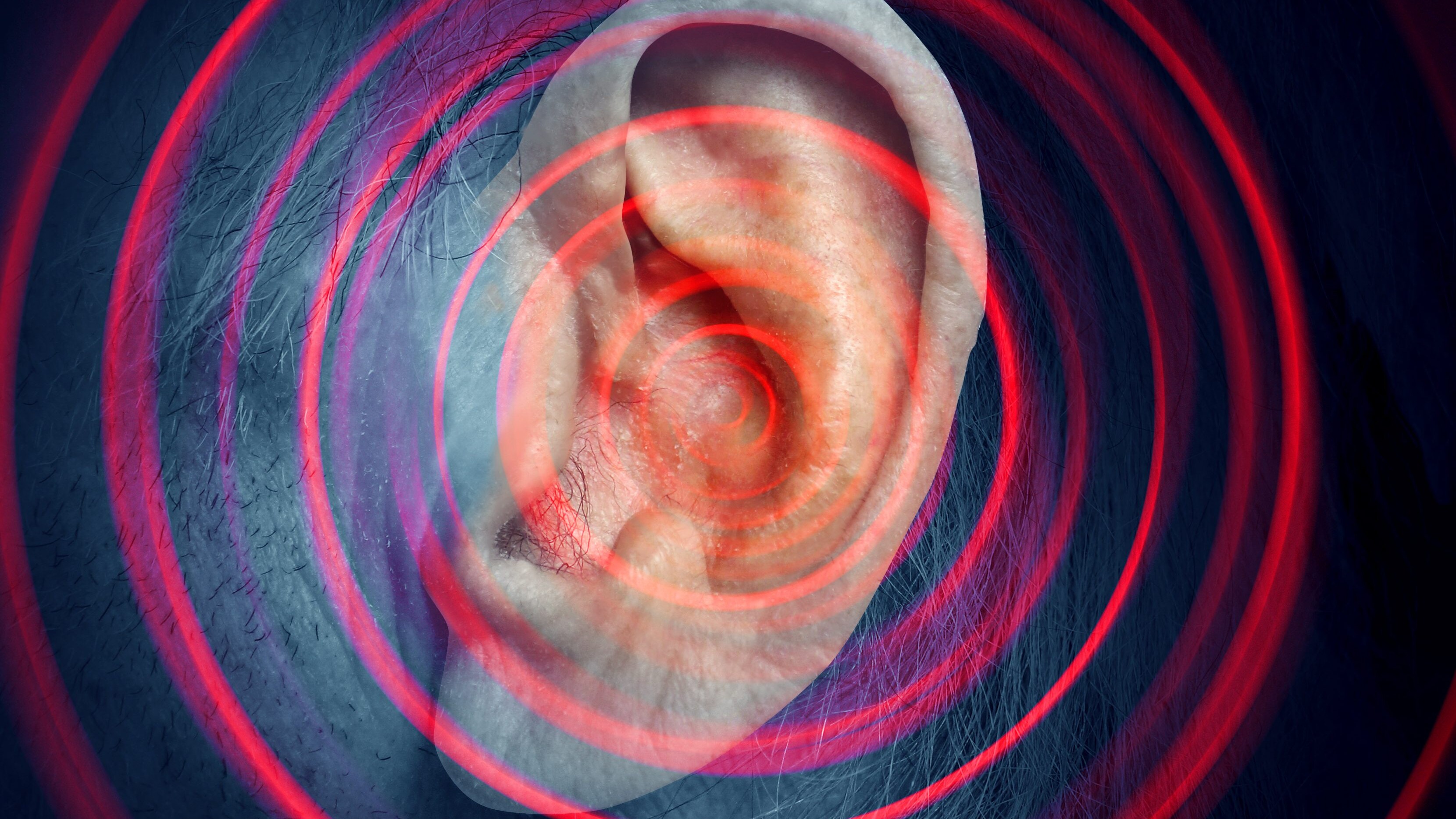 Acufene tinnito orecchio