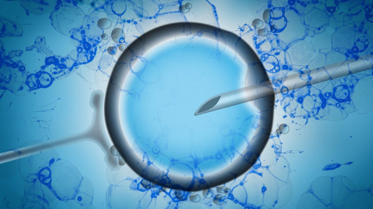 fecodnazione assistita