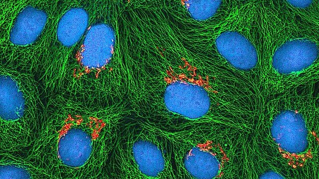 HeLa cells