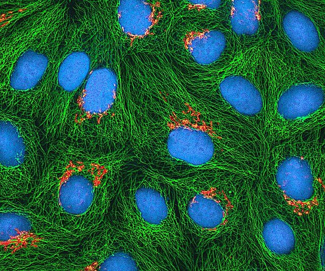 HeLa cells
