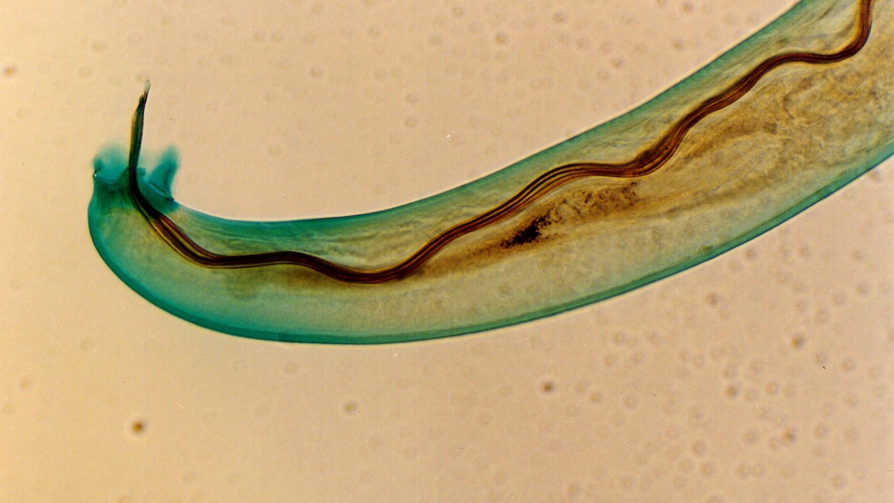 Angiostrongylus_cantonensis_Male