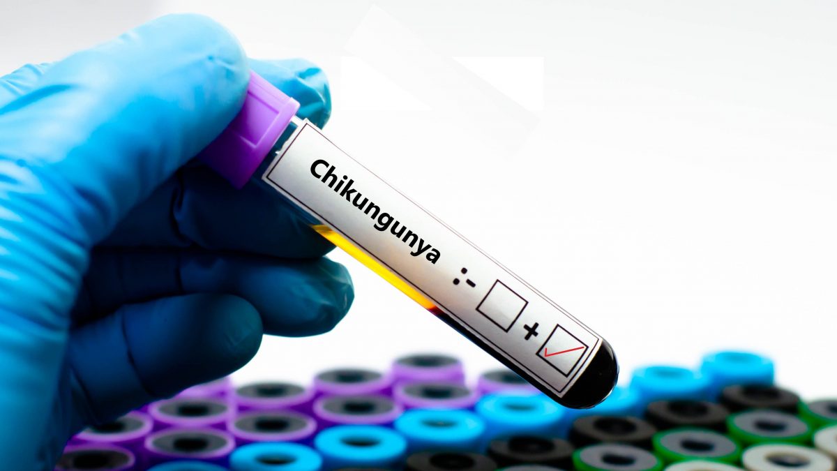 chikungunya