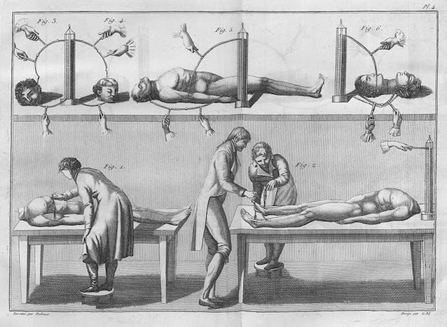 Illustrazione degli esperimenti di Aldini (Wikimedia Commons)
