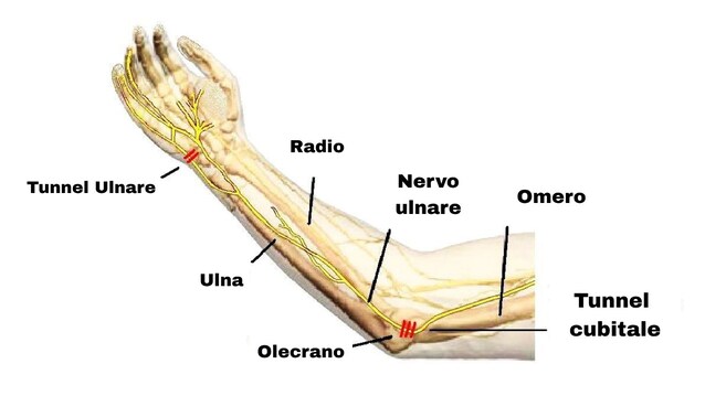 nervo ulnare