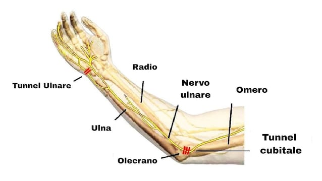 nervo ulnare