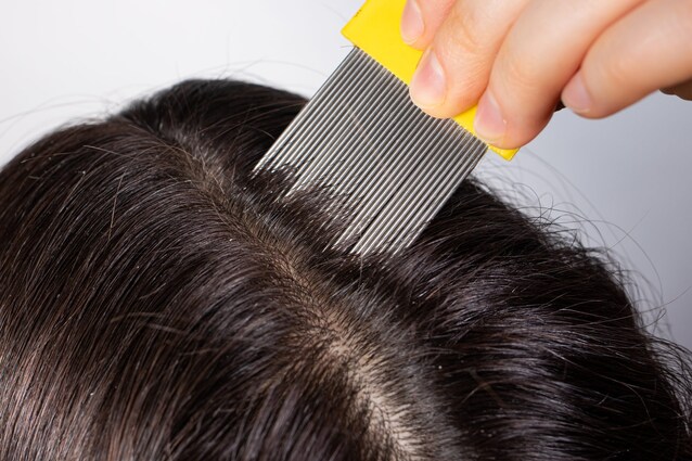 pettine a denti fitti pidocchi