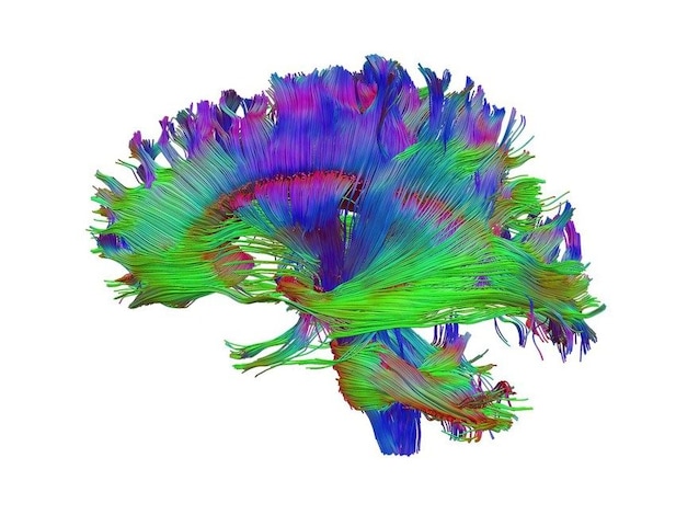 neuroni
