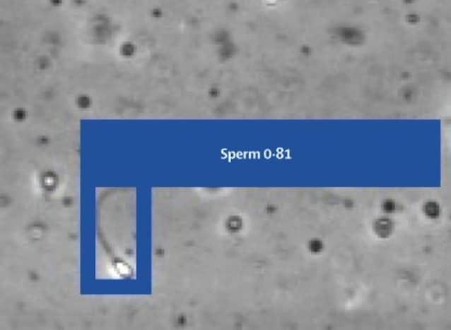 sperm tracking STAR