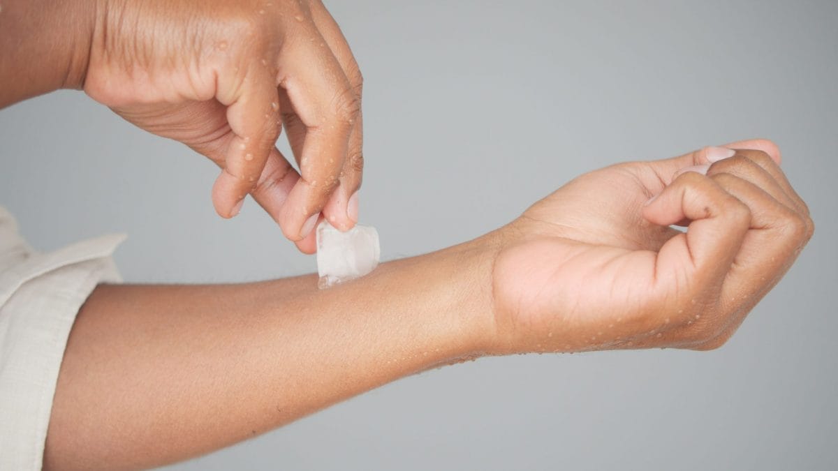 bruciare con il ghiaccio