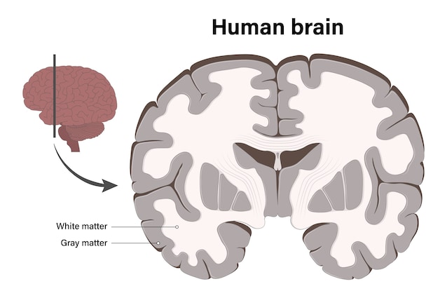 materia grigia e bianca cervello