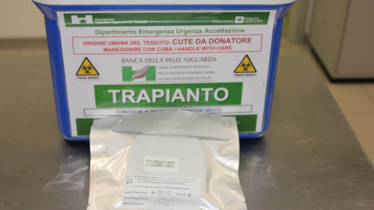 banca dei tessuti cute doantore