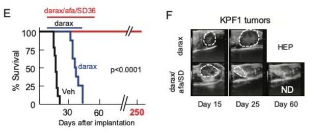 grafici studio tumore pancreas