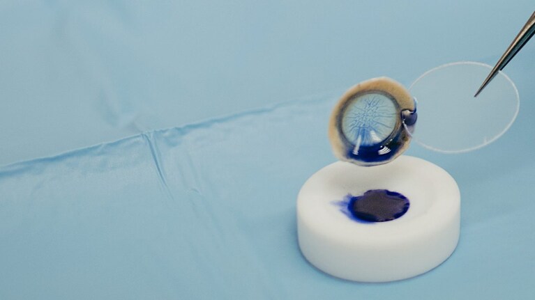 Come funziona il trapianto di cornea: siamo entrati in una Banca degli Occhi