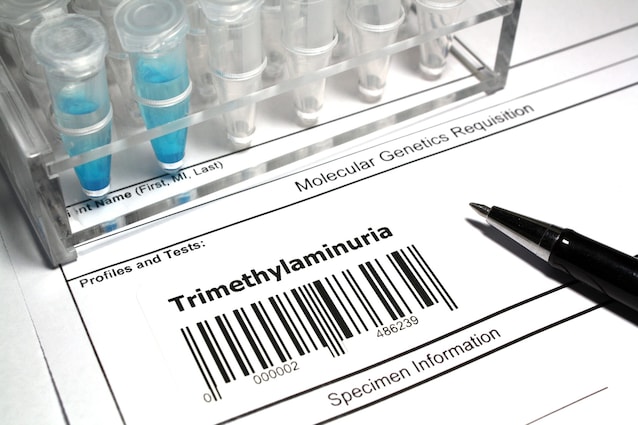 diagnosi trimetilaminuria