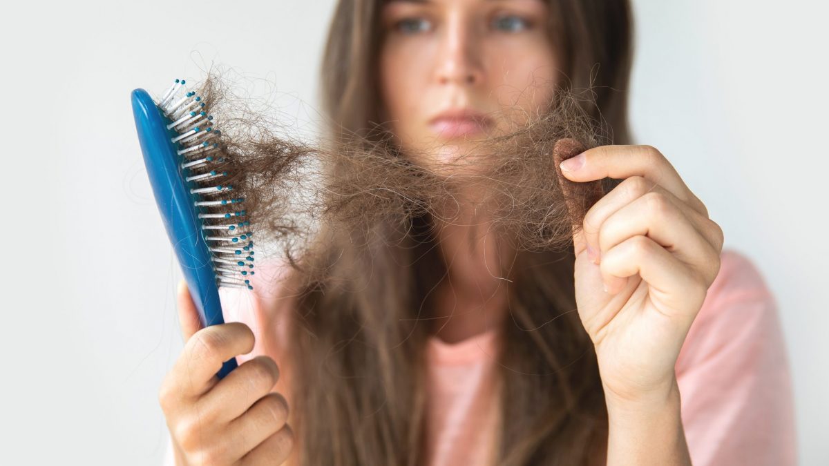 perdita capelli alopecia