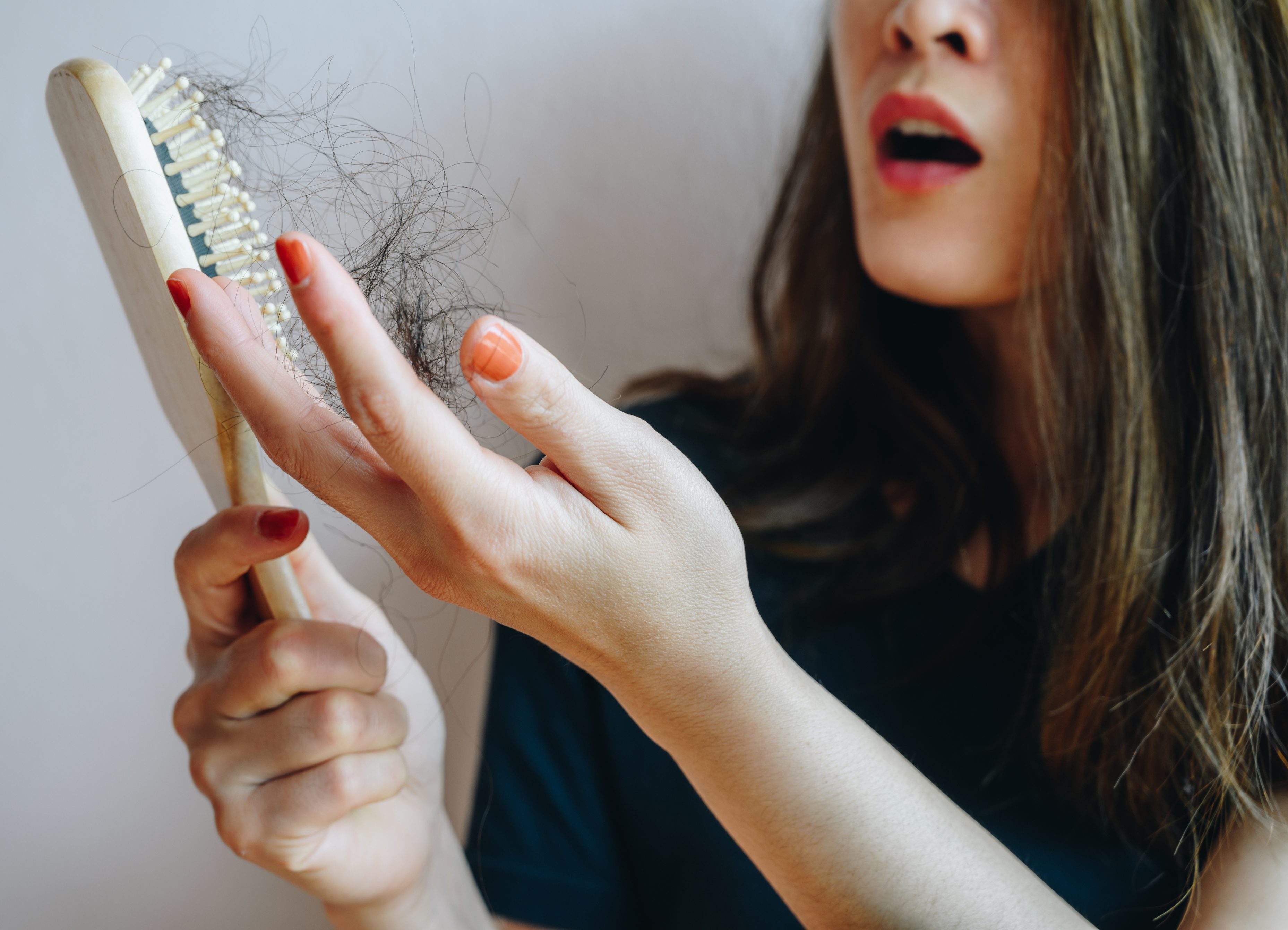 stress e perdita di capelli
