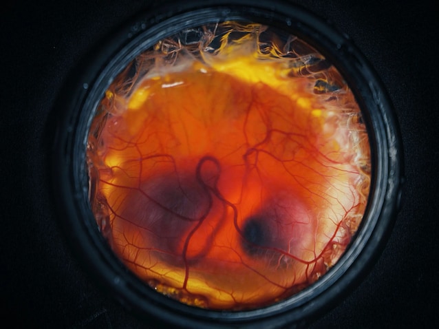 EmbryoDevelopment (1)