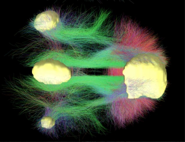 rete neurale default