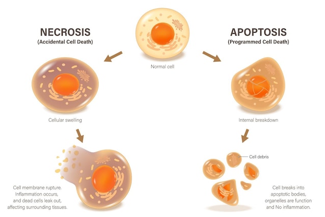 apoptosi vs necrosi