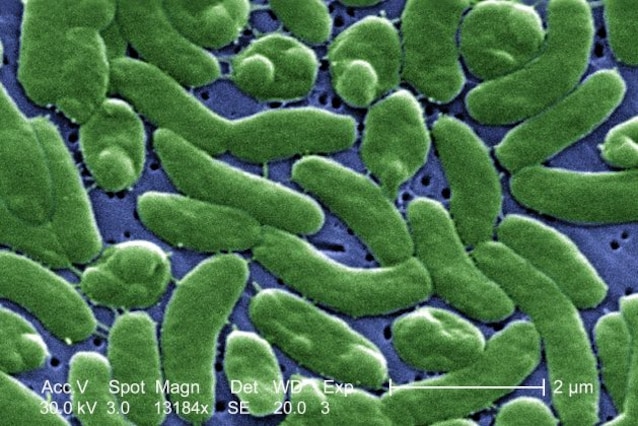 Vibrio_vulnificus_01